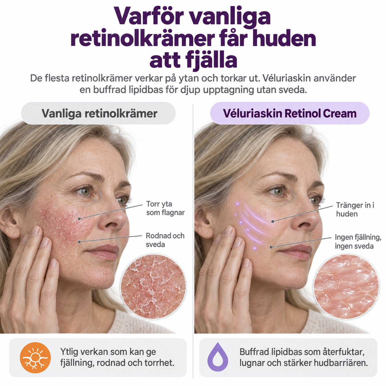 Jämförelse mellan vanliga retinolkrämer och Véluriaskin Retinol Cream